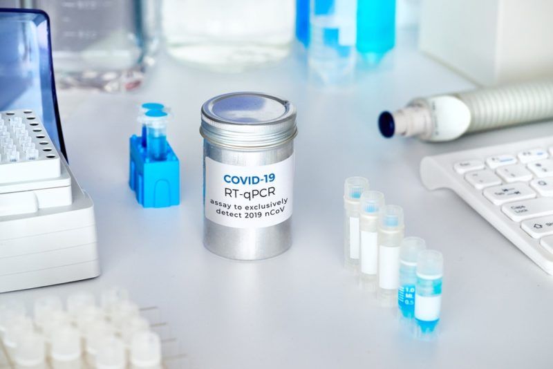 Un test pour mesurer le degré d'immunité au COVID-19